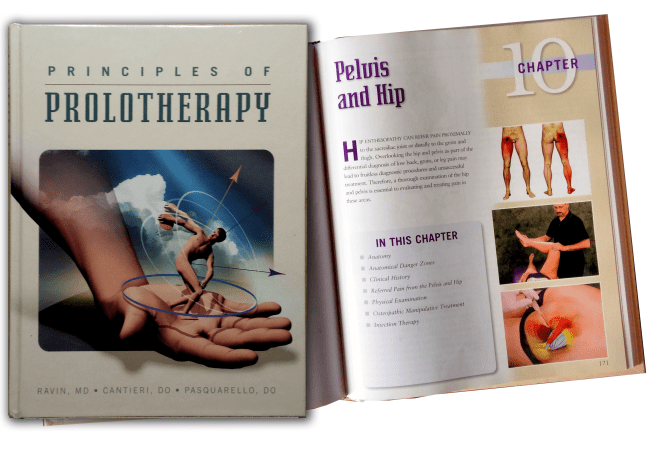 prolotherapy